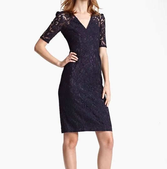 Burberry Lace Dress